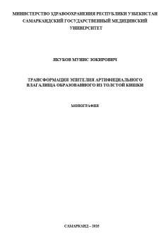 Трансформация эпителия артифициального влагалища образованного из толстой кишки