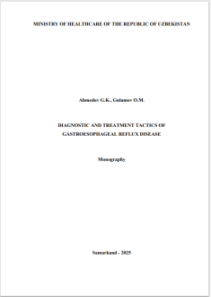 Diagnostic and treatment tactics of gastroesophageal reflux disease