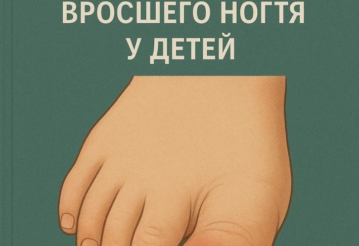 Научные основы профилактики гнойных осложнений вросшего ногтя у детей