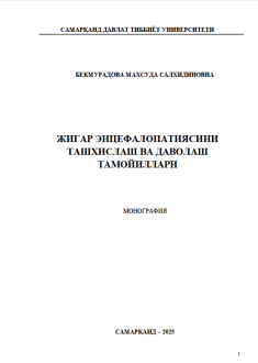 Жигар энцефалопатиясини ташхислаш ва даволаш тамойиллари