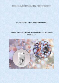Karies  kasalligi, davoilash va profilaktik chora -tadbirlari
