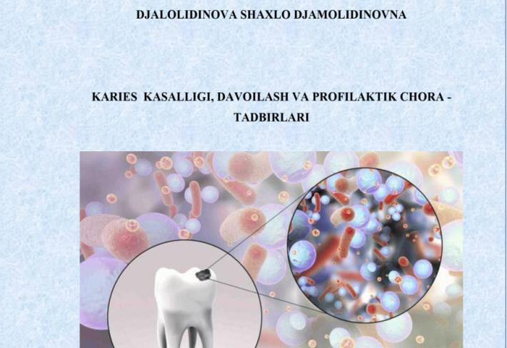 Karies  kasalligi, davoilash va profilaktik chora -tadbirlari