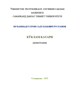 Кўклам катари