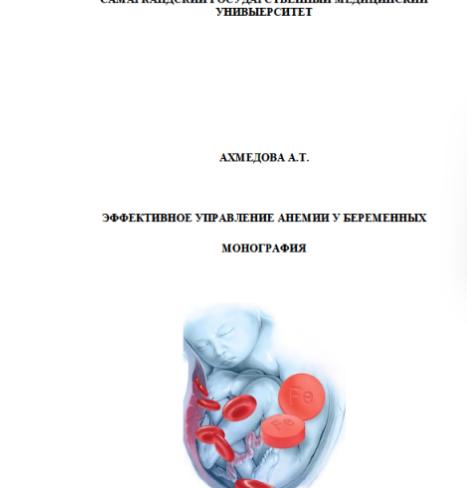 Эффективное управление анемии у беременных