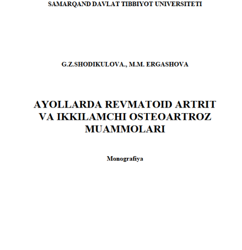 Ayollarda revmatoid artrit va ikkilamchi osteoartroz muammolari