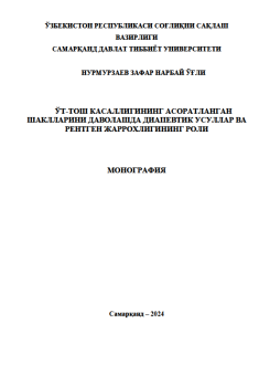 Ўт-тош каcаллигининг аcоратланган  шаклларини даволашда диапевтик уcуллар ва  рентген жаррохлигининг роли