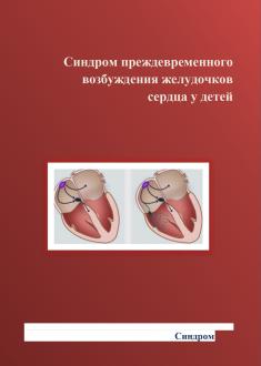 Синдром преждевременного воз-буждения желудочков сердца у детей