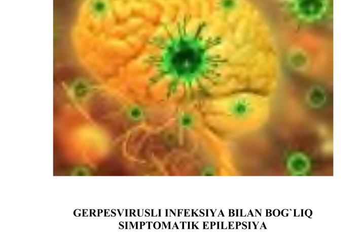Gerpesvirusli infeksiya bilan bog`liq simptomatik epilepsiya