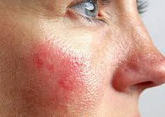 Проблемы  лечения и профилактики заболеваний кожи при спортивной деятельности в условиях жаркого климата